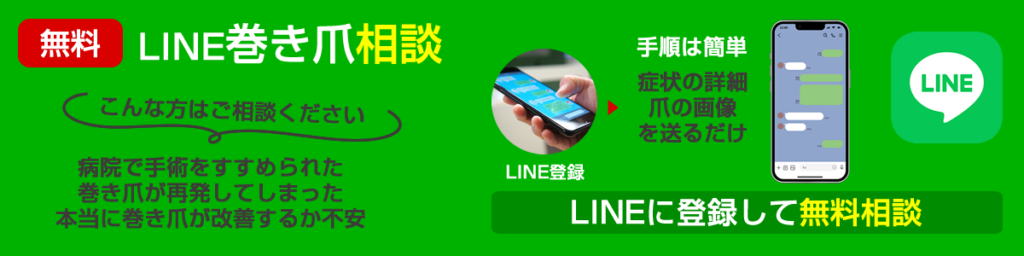 無料LINE巻き爪相談