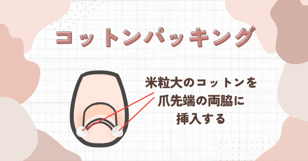 コットンパッキングの方法