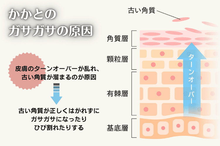 かかとがガサガサになる原因