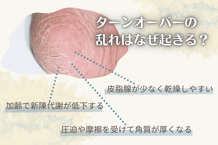 肌のターンオーバーの乱れはなぜ起きる？