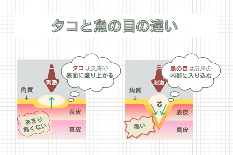 タコと魚の目の違い