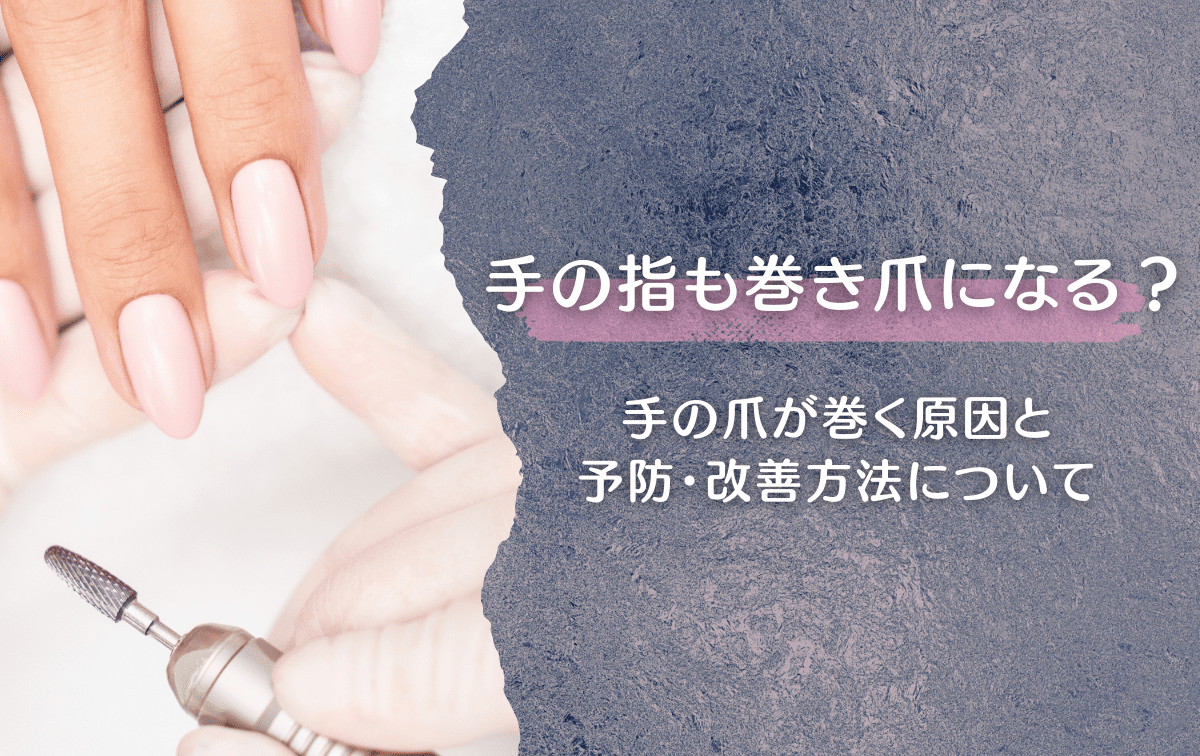 手の指も巻き爪になる？手の爪が巻く原因と予防・改善方法について