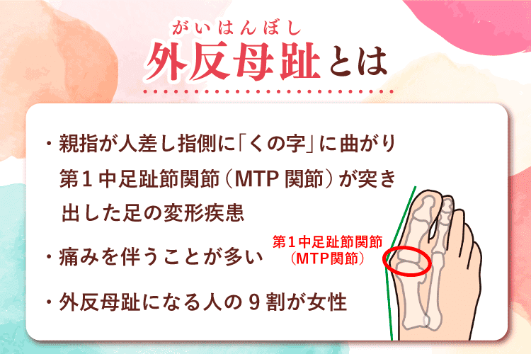 外反母趾とは