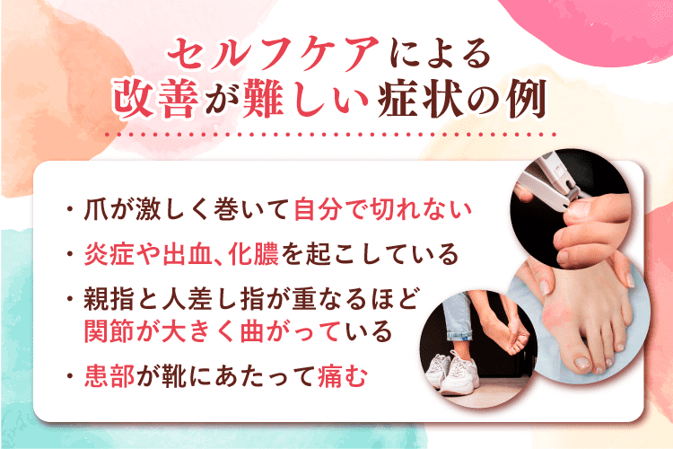 セルフケアによる改善が難しい巻き爪・外反母趾の症状例