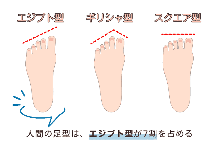 人間の足型は、エジプト型が70％程度、ギリシャ型が25％程度、スクエア型が5％程度