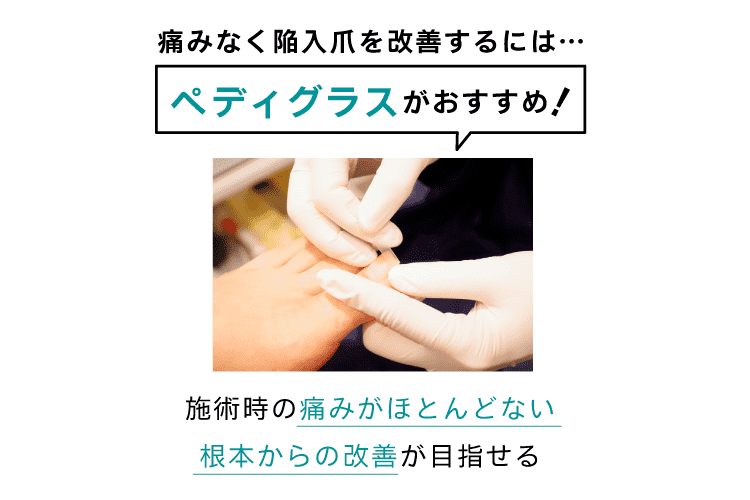 痛みなく陥入爪を改善するには「ペディグラス」の補正がおすすめ