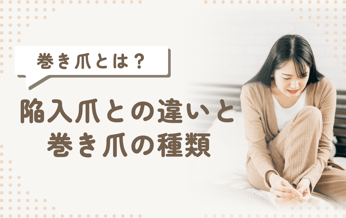 巻き爪とは？陥入爪との違いや巻き爪の種類を解説