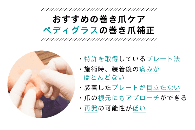 保険適用外でおすすめの巻き爪ケアは、ペディグラスの巻き爪補正