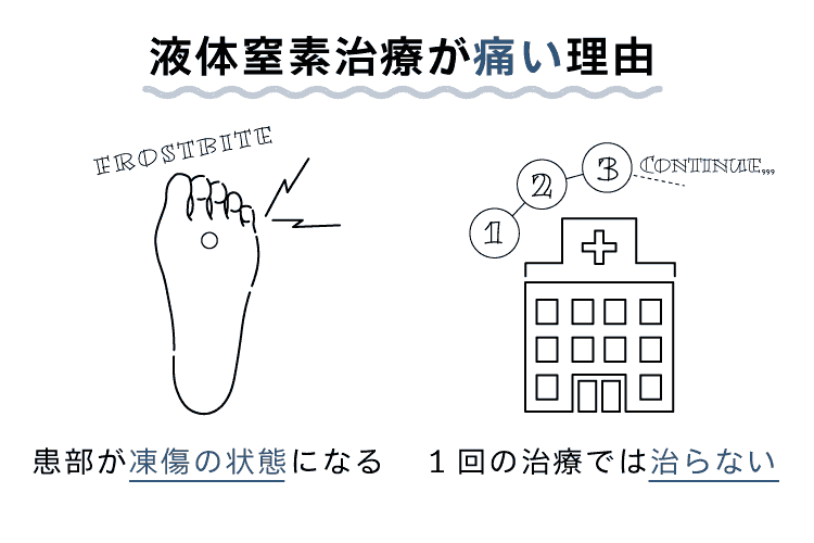 液体窒素治療が痛い理由